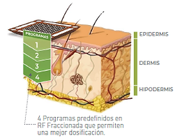 PROGRAMAS RF FRACCIONADA.png