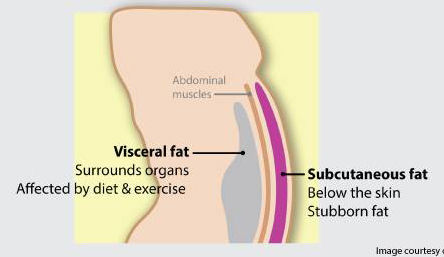 The Two Fats - Visceral vs. Subcutaneous