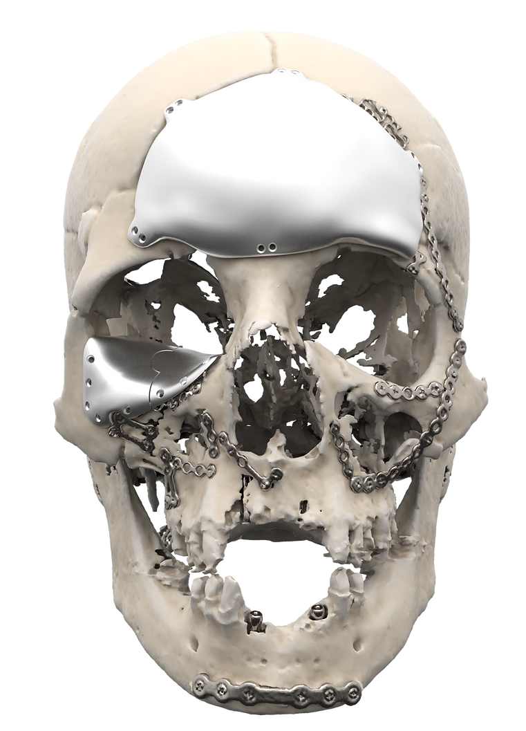 Frontal.png