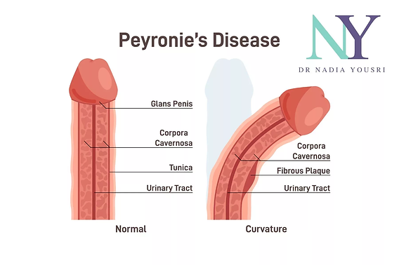 what are the side effects of ghk cu peptide The Benefits & Risks of GHK-Cu (WATCH BEFORE TAKING) what are the side effects of ghk cu peptide The Benefits & Risks of GHK-Cu (WATCH BEFORE TAKING)