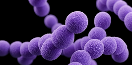 Histoplasmosis example photo to represent the sanitation services offered by ITS Environmental Services