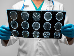 Investigadores chilenos clave en nuevo avance en inmunoterapia del cáncer