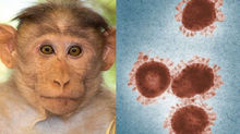 Help to find a new name for the monkeypox virus