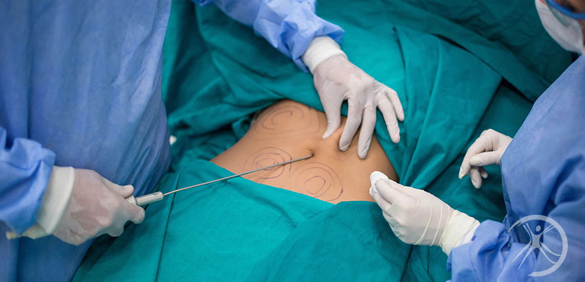 Plano de saúde terá de autorizar e custear cirurgias reparadoras de beneficiária que fez bariátrica