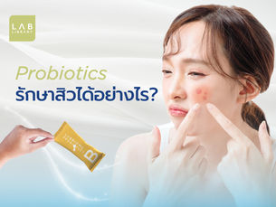Probiotics รักษาสิวได้อย่างไร?