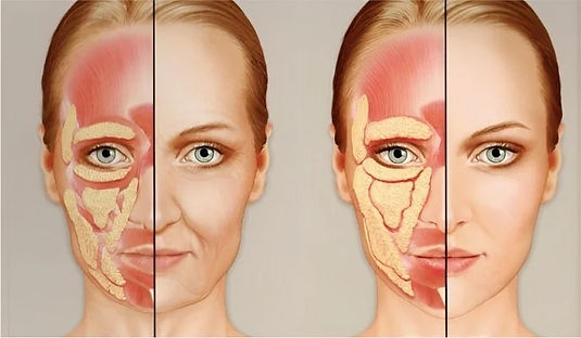 Lipoenxertia de Face