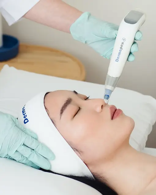 image_what_is_microneedling_benefits.webp