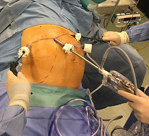 Chirurgia mininvasiva - laparoscopia e robotica