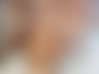 The Benefits of Non-Surgical Facelifts