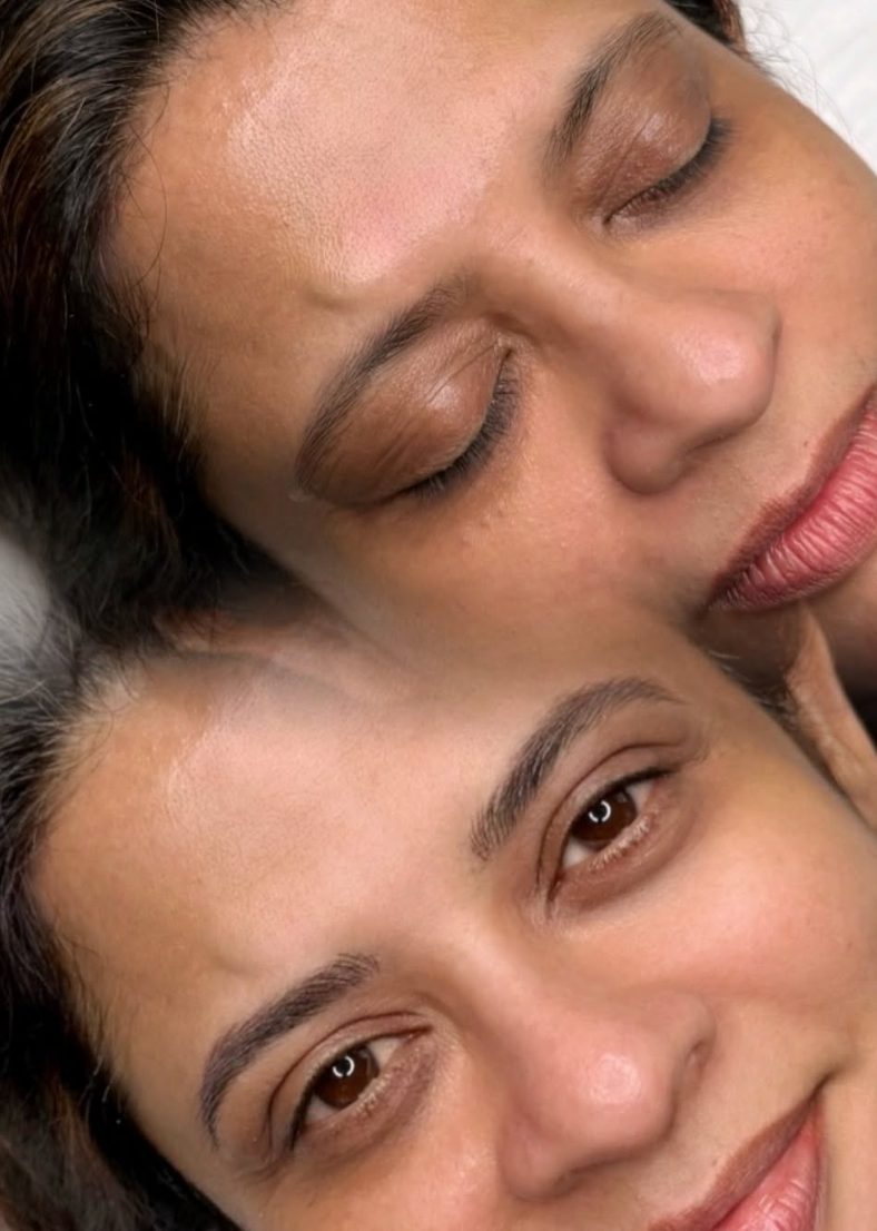 eyebrow treatment northampton