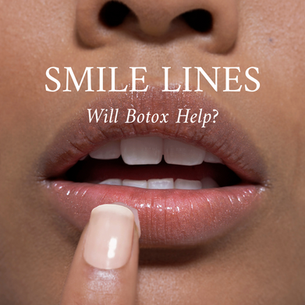 Will Botox Help Smile Lines?