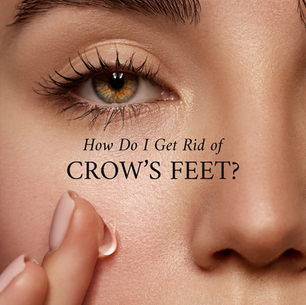 How Do I Get Rid of Crow's Feet?