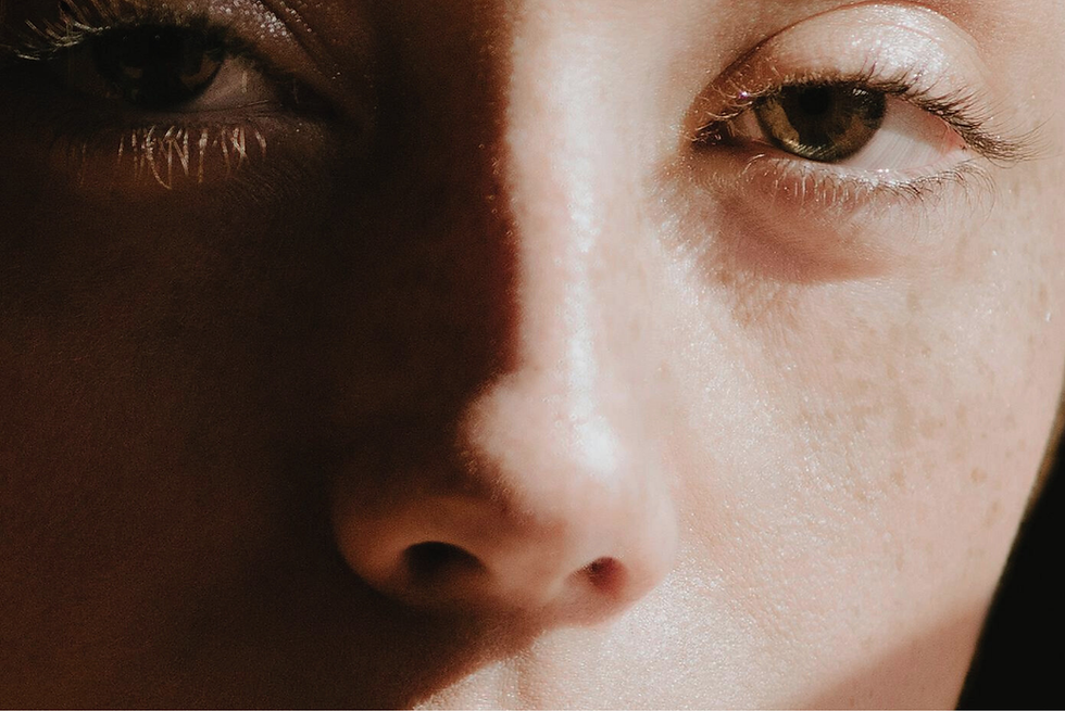 SWiCH Dermal Revitalisation Treatment