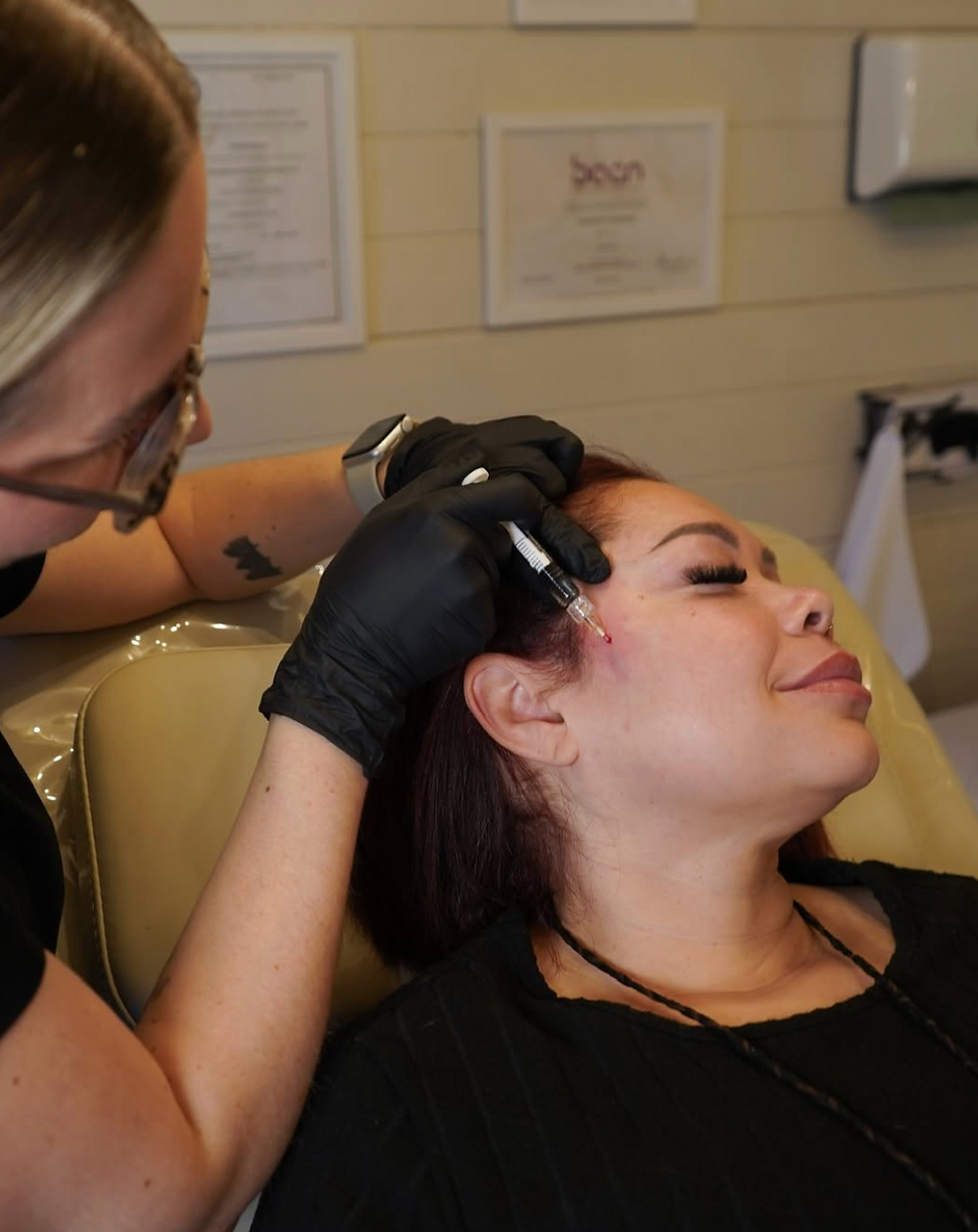 DERMAL FILLERS