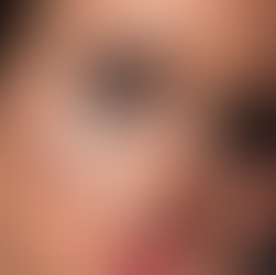 2025: The Year of Naked Injectables and Effortless Beauty