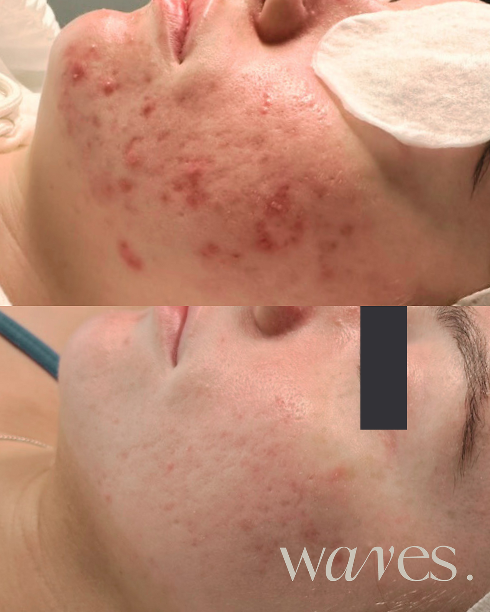 B&A1.png
