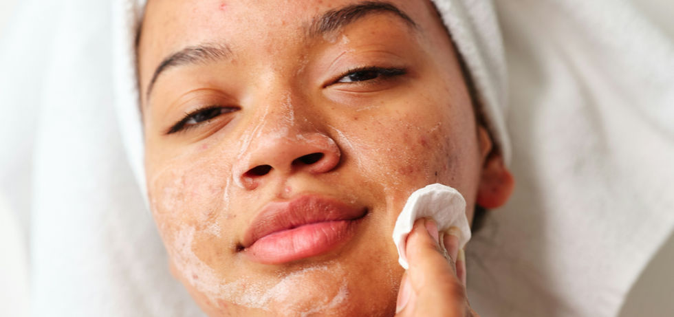 teen skincare

