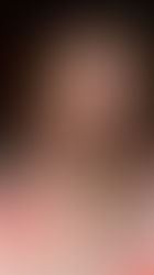 Discover the extraordinary journey of Dr. Chytra v Anand, a trailblazer in skincare and founder of Kosmoderma Healthcare Pvt Ltd. Dive into her inspiring narrative of excellence in dermatology