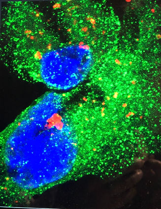 Uptake of Cancer Cell