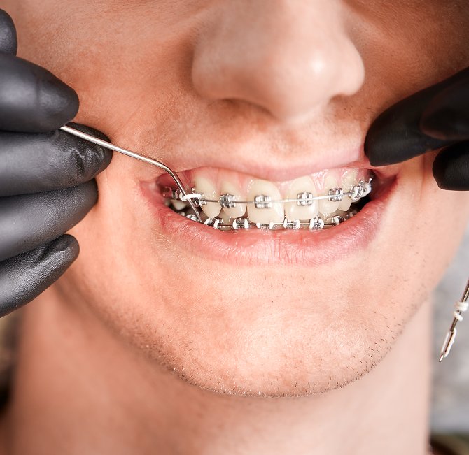 Сучасна ортодонтія