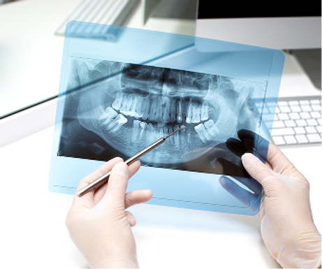 dentist-analyzes-x-ray-photo.png