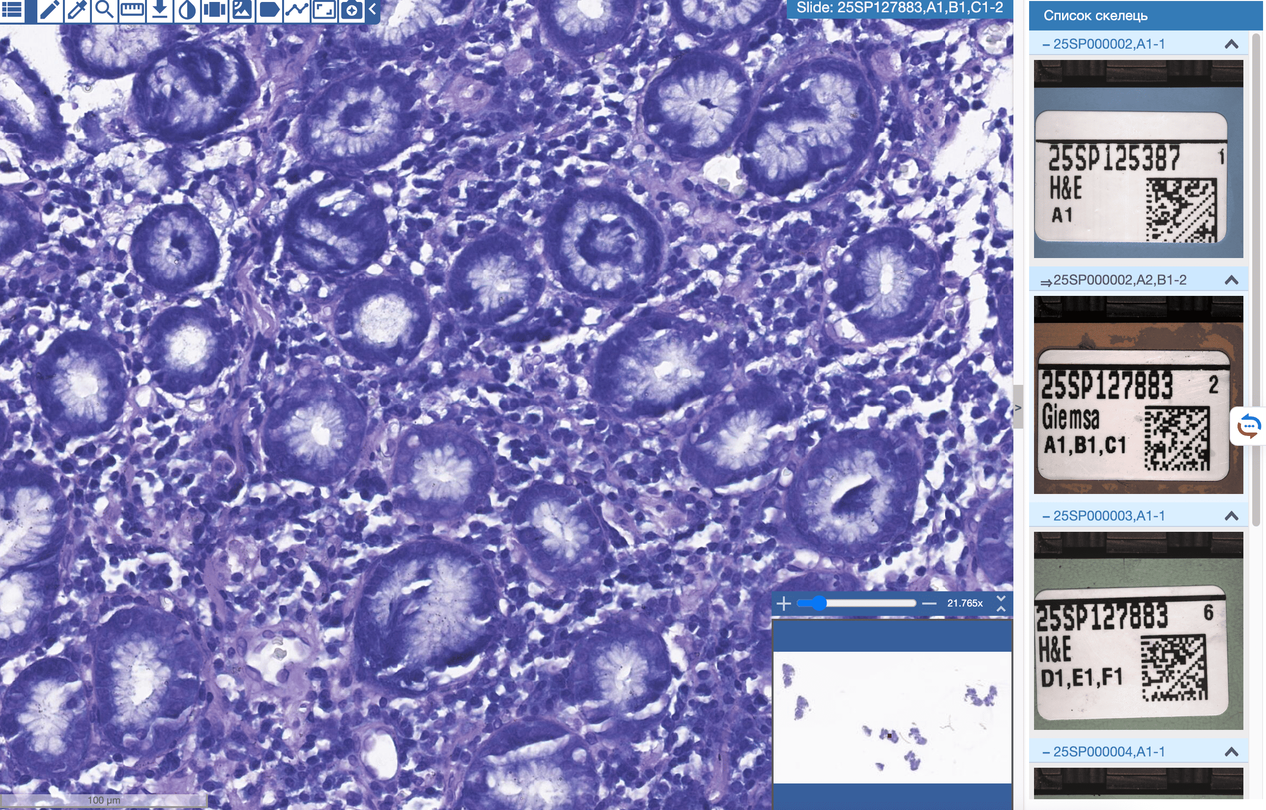 pathology slide viewer (1).png