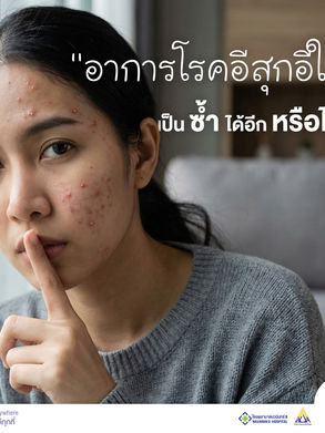 "โรคอีสุกอีใส" (Chickenpox): อาการ การดูแลตัวเอง และวิธีป้องกัน
