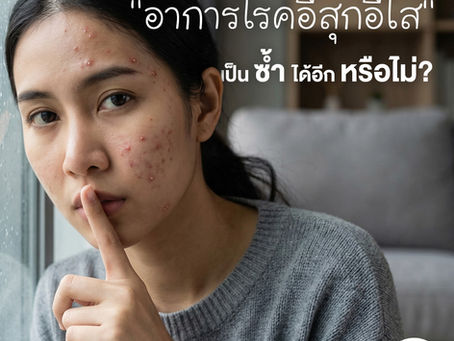 "โรคอีสุกอีใส" (Chickenpox): อาการ การดูแลตัวเอง และวิธีป้องกัน