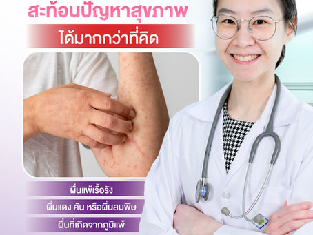 โรคผิวหนัง อย่าคิดว่าเป็นแล้ว ปล่อยไปก็หายเอง เพราะสะท้อนถึงปัญหาสุขภาพได้มากกว่าที่คิด