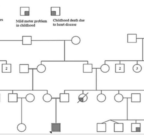Figure 3- the pedigree of a patient suffering with CEDS, illustrating the rarity of the disease