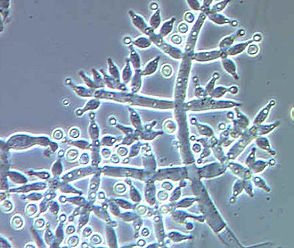 5-Trichoderma.jpg