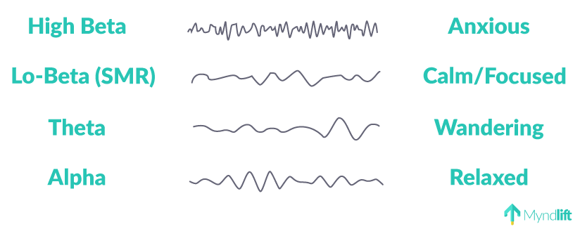 brainwave frequenceis