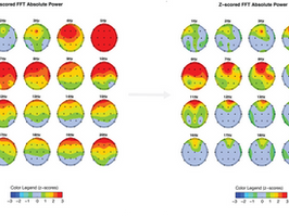 Home Neurofeedback at Behavioral Associates