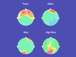 What Does Science Say About Neurofeedback?