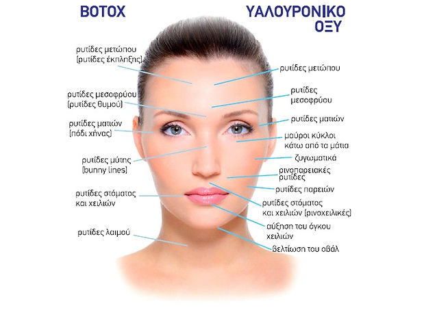 botox parts.jpg