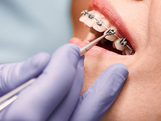 Best Orthodontist in Nashik