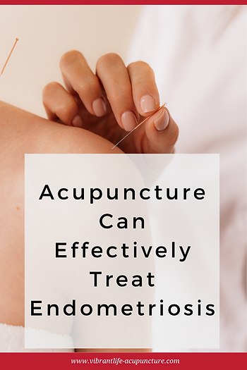 Acupuncture treats endometriosis
