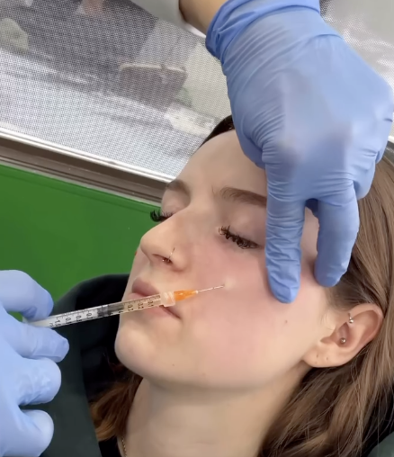 Registered Nurse, Brenda Patten, performing PRP under eye treatment on a client.