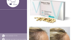 Secret Faces Oakville-branded template with Viviscal™ PRO supplements on the right, and a before-and-after image below showing hair growth results.