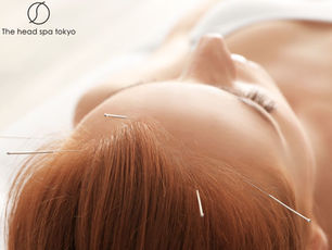 Scalp Acupuncture: Japan’s Needle Therapy for Enhanced Hair Growth & Scalp Health 🎯🌿✨