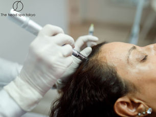 Scalp Microneedling: Japan’s Cutting-Edge DIY & Salon Protocols for Thicker, Healthier Hair 🌿🛠️✨