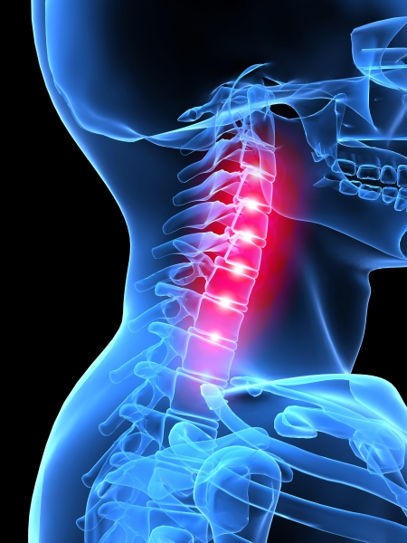 Neck pain, headaches