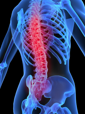General Back Pain