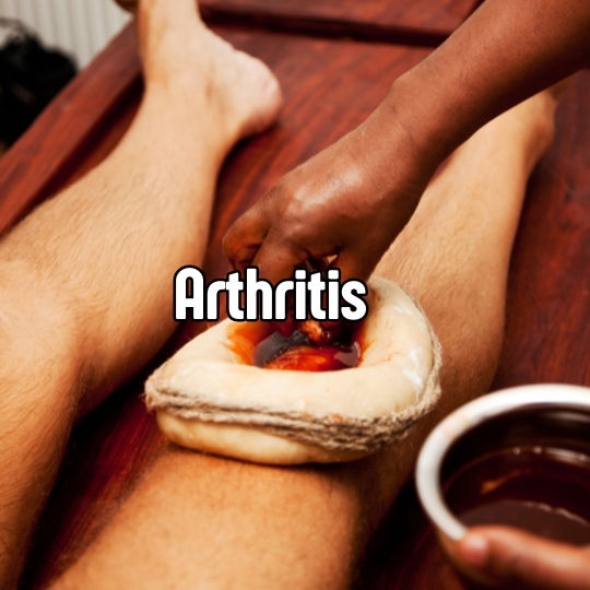 Arthritis1