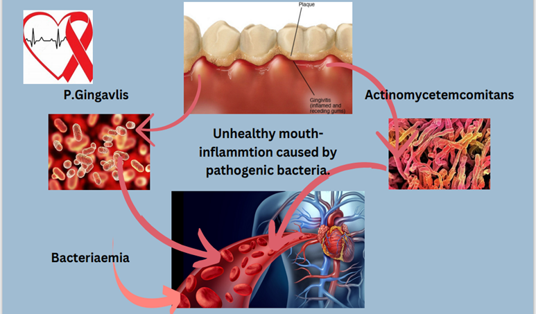 Heartfelt Matters: Decoding the Silent Threat of Gum Health on Cardiovascular Wellness