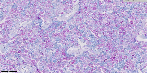 MCT dog 40x Giemsa stain.jpg