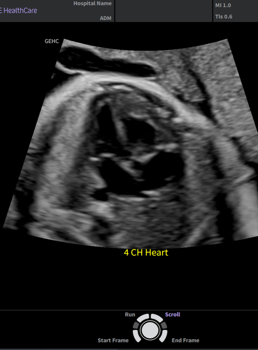 Scan Assistant1_edited.jpg