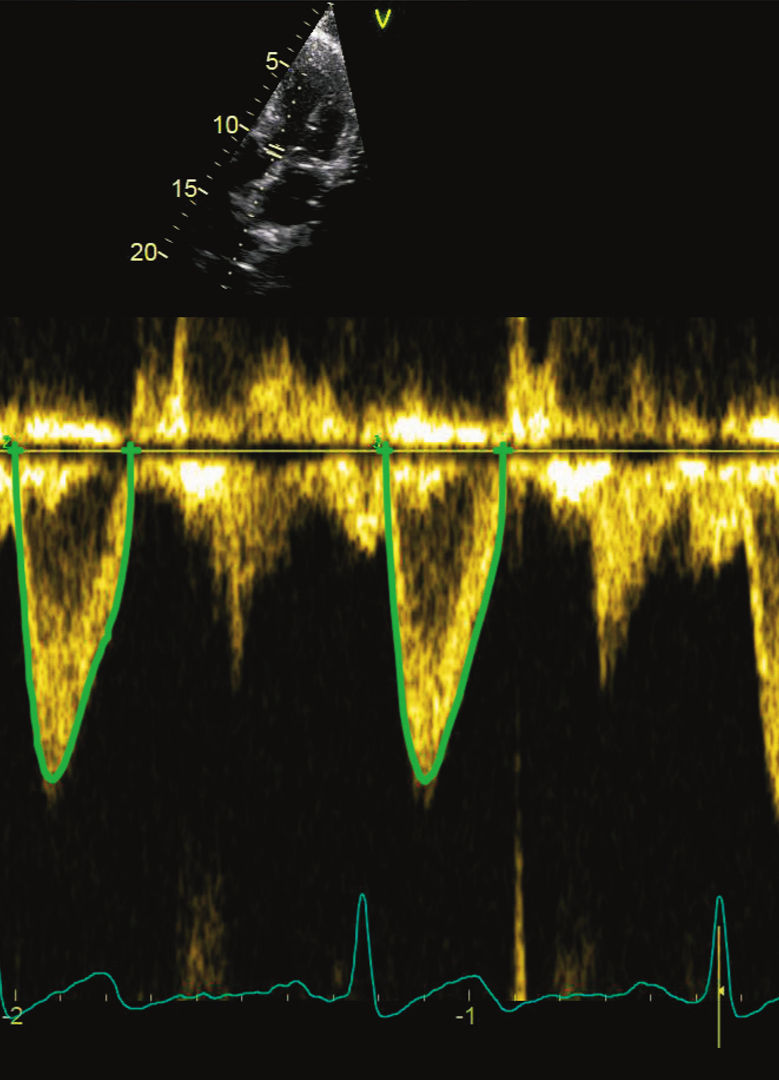 Vivid-S70_AI-Cardiac-Auto-Doppler_edited.jpg