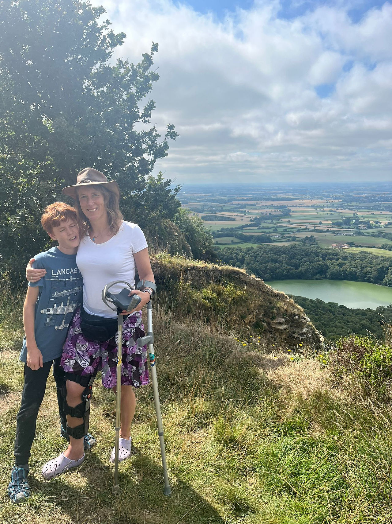 An image of Katie and Harry out in nature. They are standing to the left of the frame. Katie wears shorts and t-shirt, with a summer hat. She has a brace to her right knee and is holding crutches. She has her arm around Harry, who wears a blue t-shirt and joggers. There is grass and foliage in the background, and a cloudy blue sky overhead.