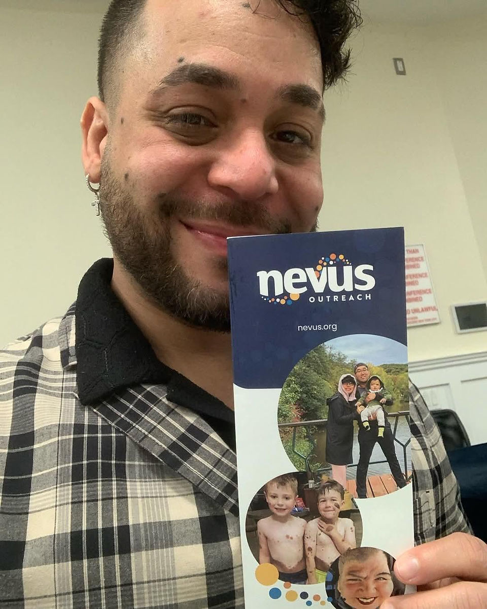 Smiling person holding a Nevus Outreach pamphlet with family photos, wearing a plaid shirt. Bright indoor setting.